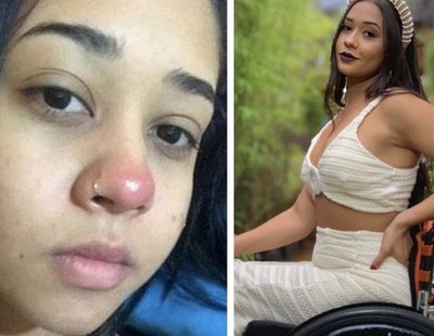 Layane Dias, la joven que quedó parapléjica tras una complicación por un piercing