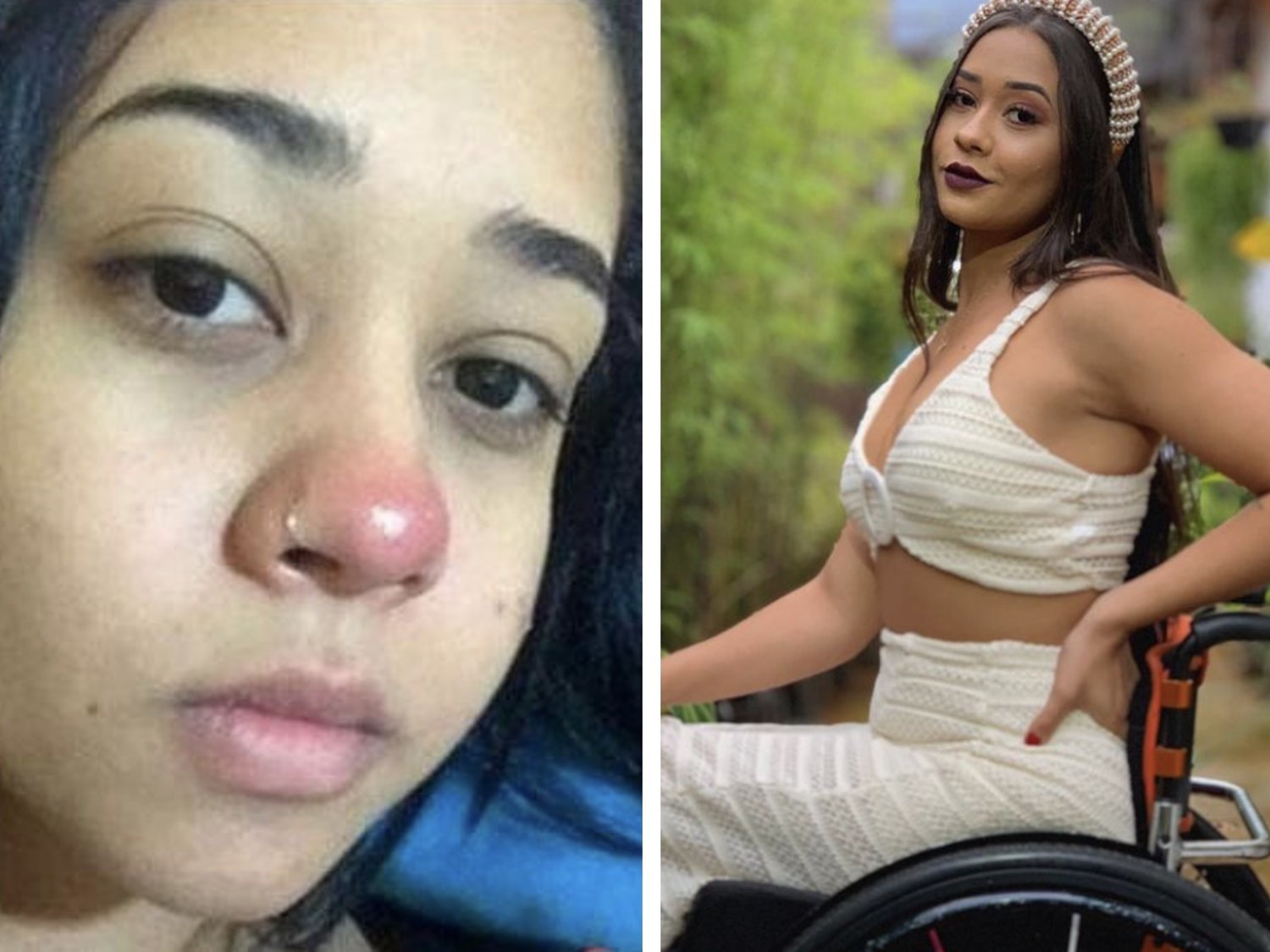 Layane Dias, la joven que quedó parapléjica tras una complicación por un piercing