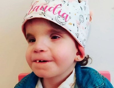 Campaña de crowdfunding para Claudia, la primera niña en España con síndrome de Menke-Hennekam