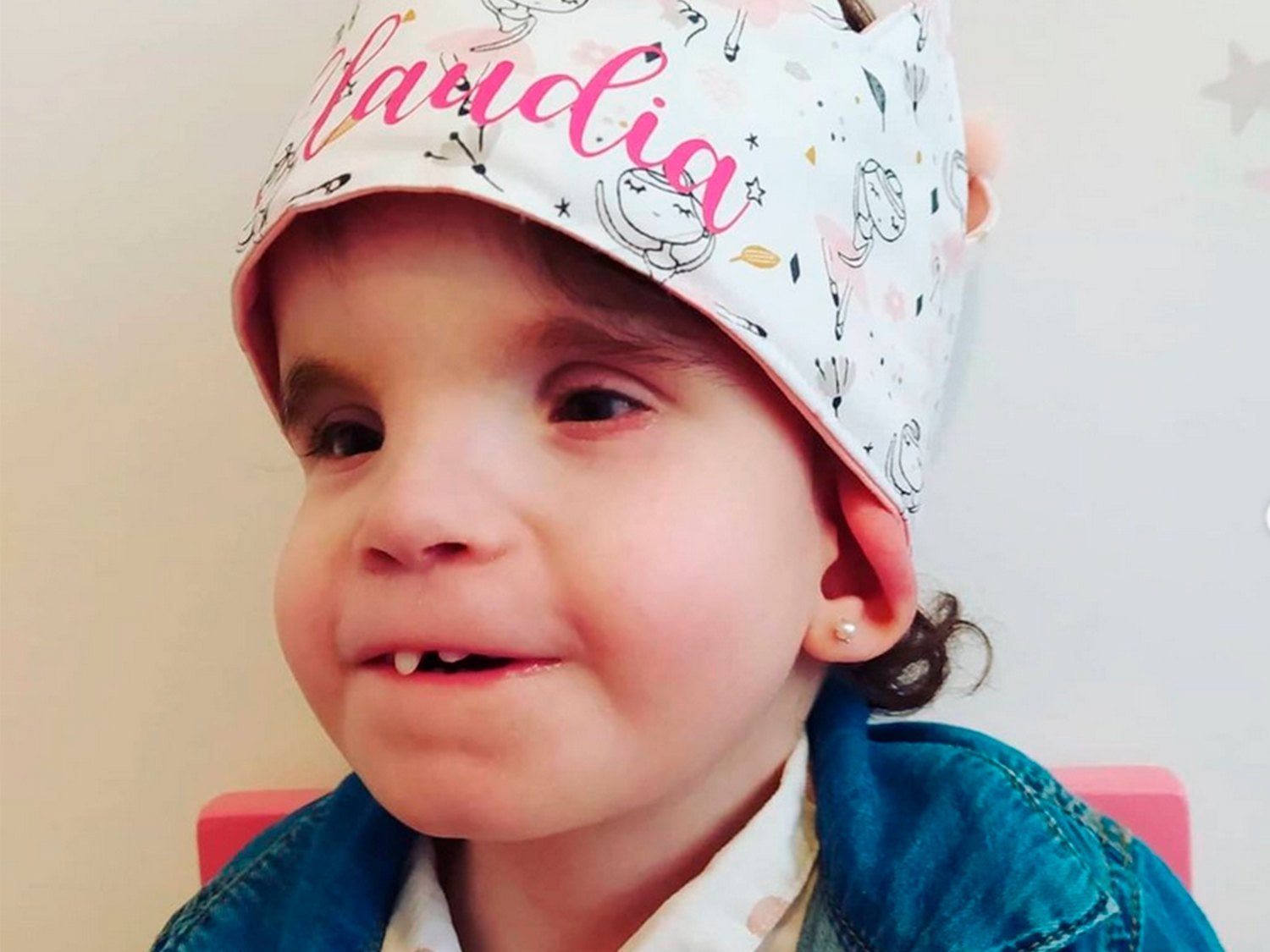 Campaña de crowdfunding para Claudia, la primera niña en España con síndrome de Menke-Hennekam