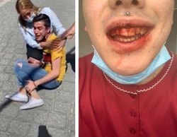 Una familia propina una brutal paliza homófoba a su hijo de 18 años en Murcia