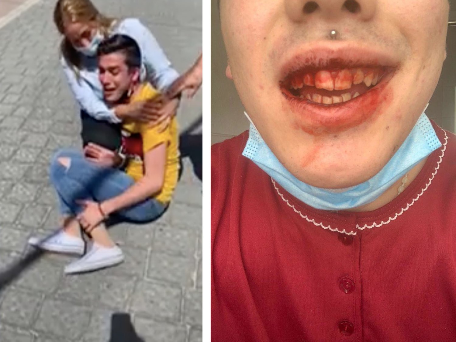 Una familia propina una brutal paliza homófoba a su hijo de 18 años en Murcia