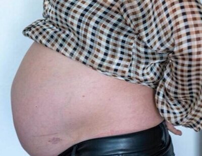 Una mujer denuncia que lleva diez años "embarazada" de nueve meses