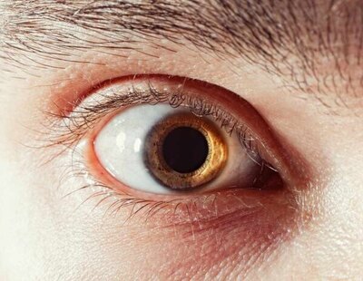 El tamaño de tu pupila determina tu inteligencia, según un estudio