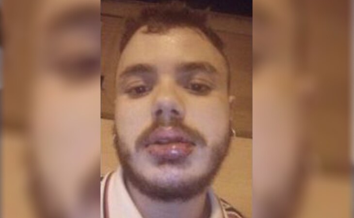 Alejandro, víctima de una agresión homófoba en Valencia