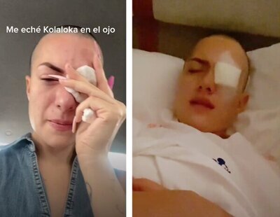 Una influencer confunde las gotas para sus ojos con pegamento y se pega el párpado