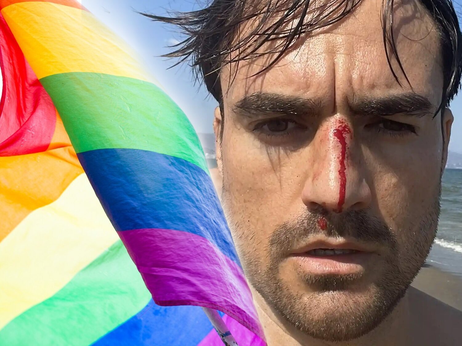 Agresión homófoba en una playa de Málaga: le da cabezazo al grito de "maricón"