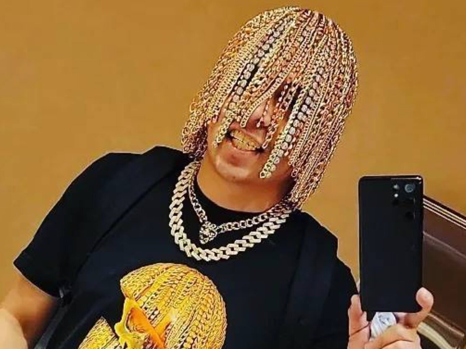 Dan Sur, el rapero que se ha implantado quirúrgicamente cadenas de oro en la cabeza