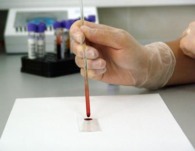 Científicos españoles crean un nuevo medicamento que reduce el contagio de VIH por vía sexual