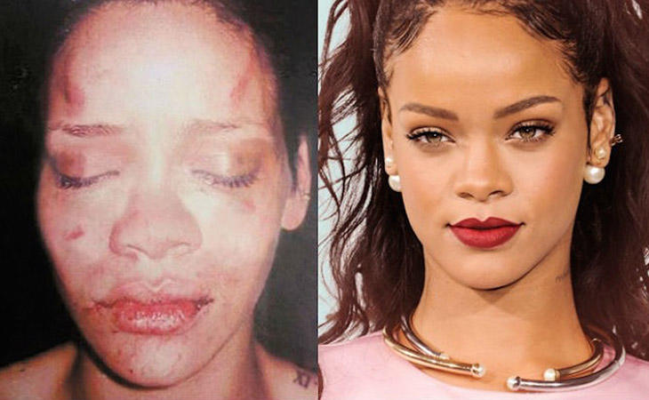 Rihanna fue brutalmente golpeada por Chris Brown