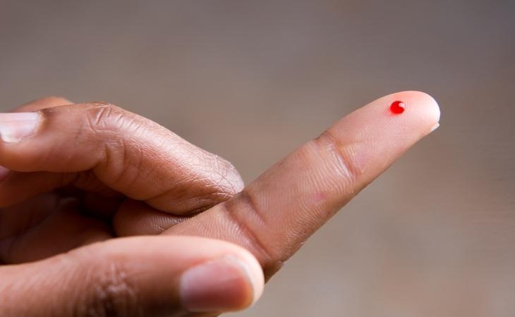 El microchip se inserta en el dedo a través de una jeringuilla manipulada por un tatuador