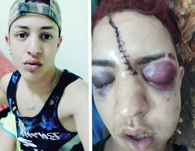 Brutal agresión homófoba: un joven residente en España, atrapado en Marruecos tras ser salvajemente golpeado y rajado en el rostro