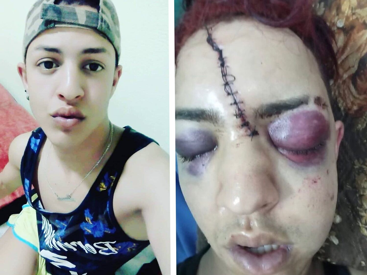 Brutal agresión homófoba: un joven residente en España, atrapado en Marruecos tras ser salvajemente golpeado y rajado en el rostro