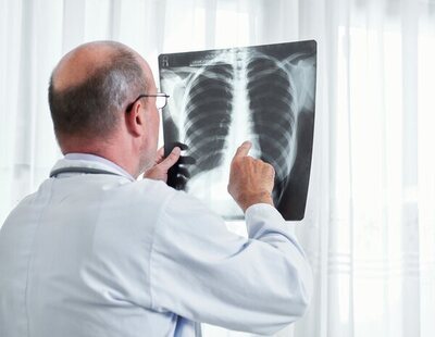 Cáncer de pulmón: síntomas que no pasar por alto y cuándo consultar con un especialista
