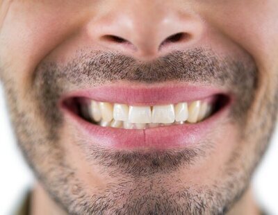 ¿Has soñado que se te caen los dientes? Este es su significado