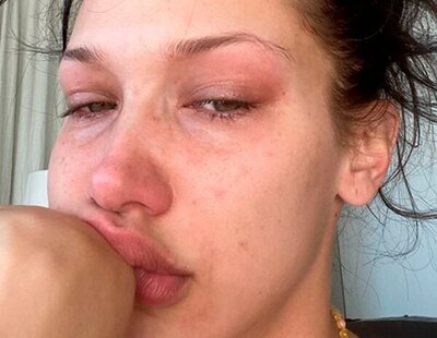 Bella Hadid habla acerca de sus problemas de depresión y ansiedad, que le impedían incluso salir de casa