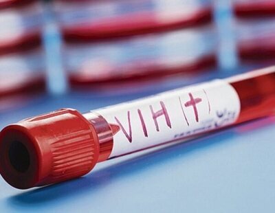 Descubren una variante del VIH más virulenta y transmisible