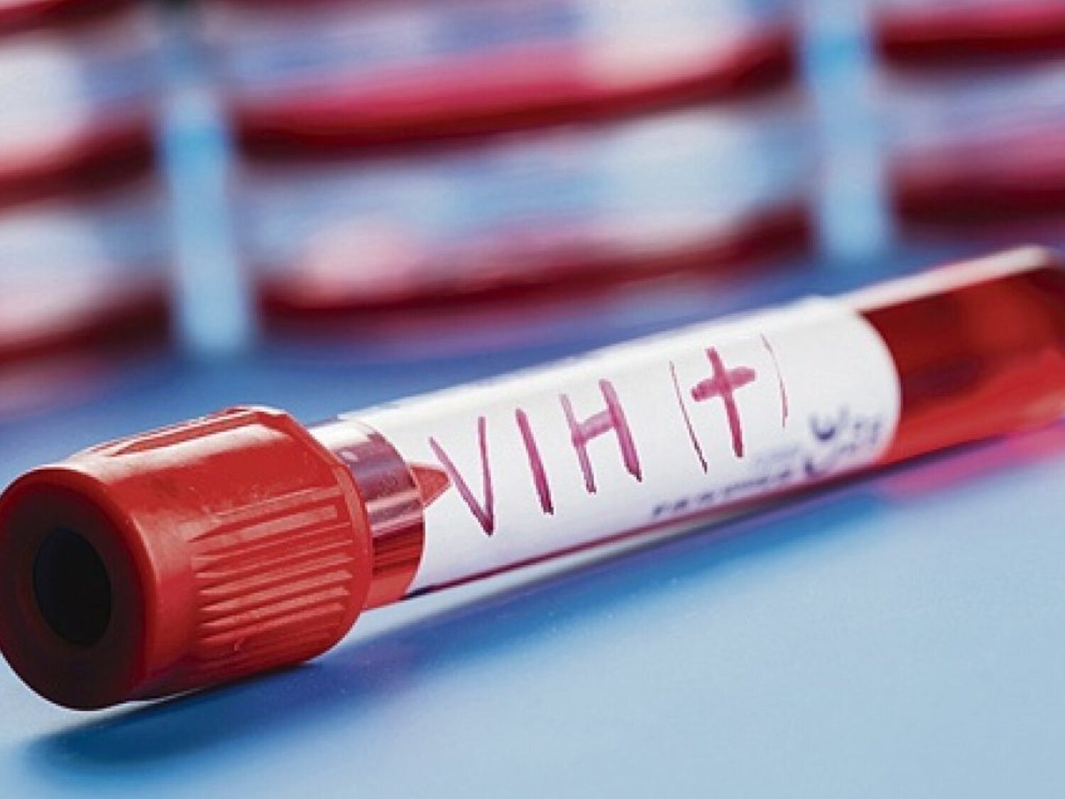 Descubren una variante del VIH más virulenta y transmisible