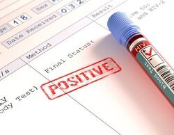 Los casos de VIH en heterosexuales superan a los de homosexuales por primera vez en 10 años