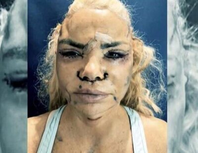 Leticia Sabater muestra su nuevo rostro tras someterse a la operación más larga de su vida