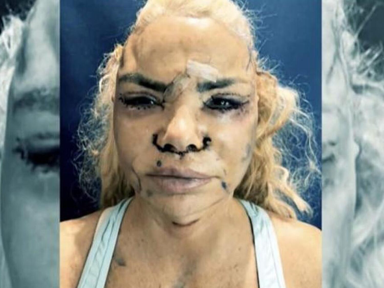 Leticia Sabater muestra su nuevo rostro tras someterse a la operación más larga de su vida
