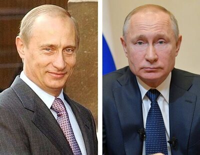 Todas las operaciones estéticas de Putin: pómulos, nariz, bótox y hasta injertos de pelo