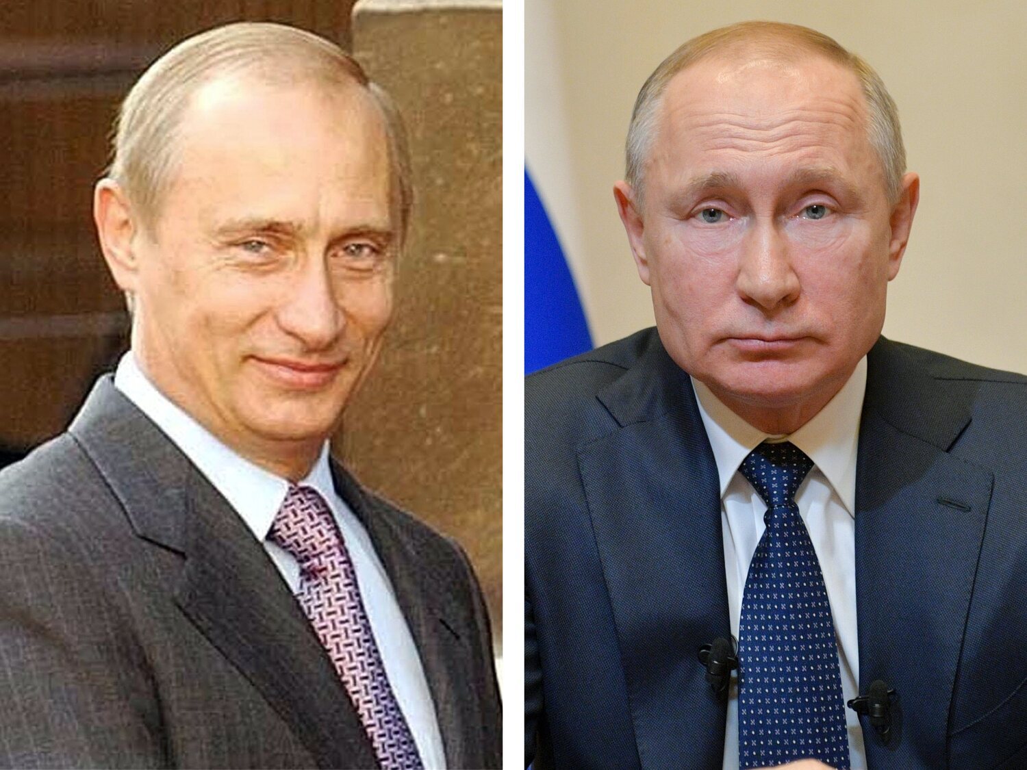Todas las operaciones estéticas de Putin: pómulos, nariz, bótox y hasta injertos de pelo
