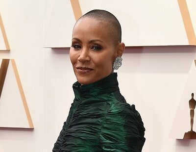 ¿Qué es el trastorno de alopecia autoinmune? Así es la enfermedad que padece Jada Pinkett