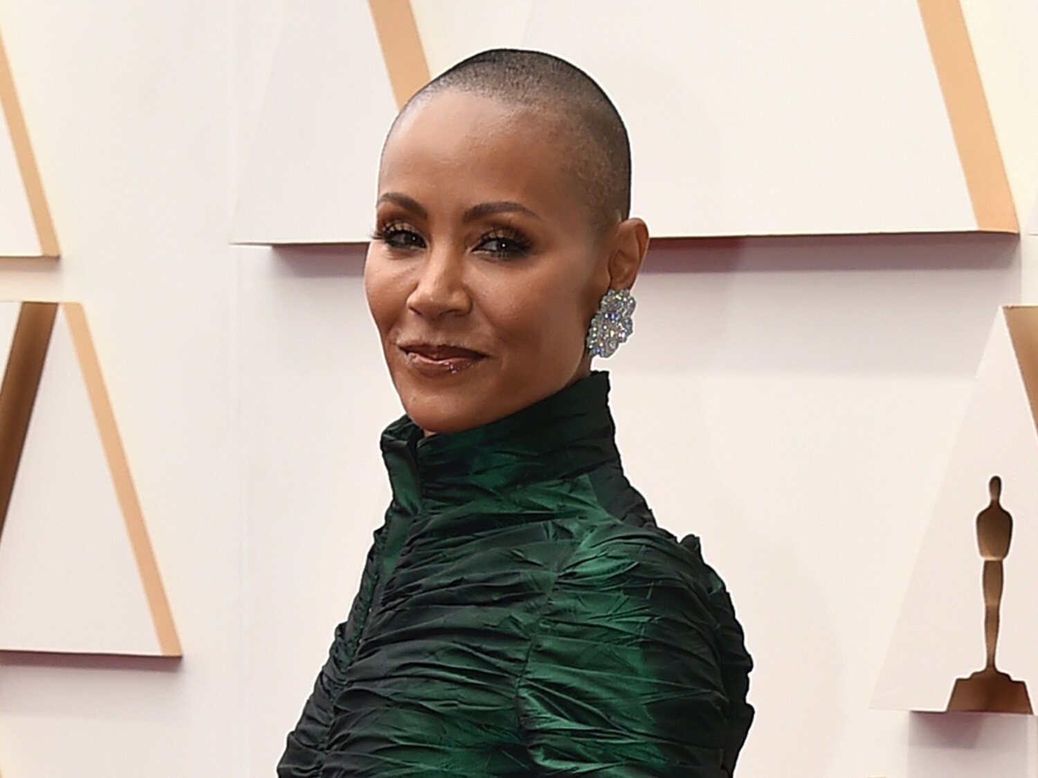 ¿Qué es el trastorno de alopecia autoinmune? Así es la enfermedad que padece Jada Pinkett