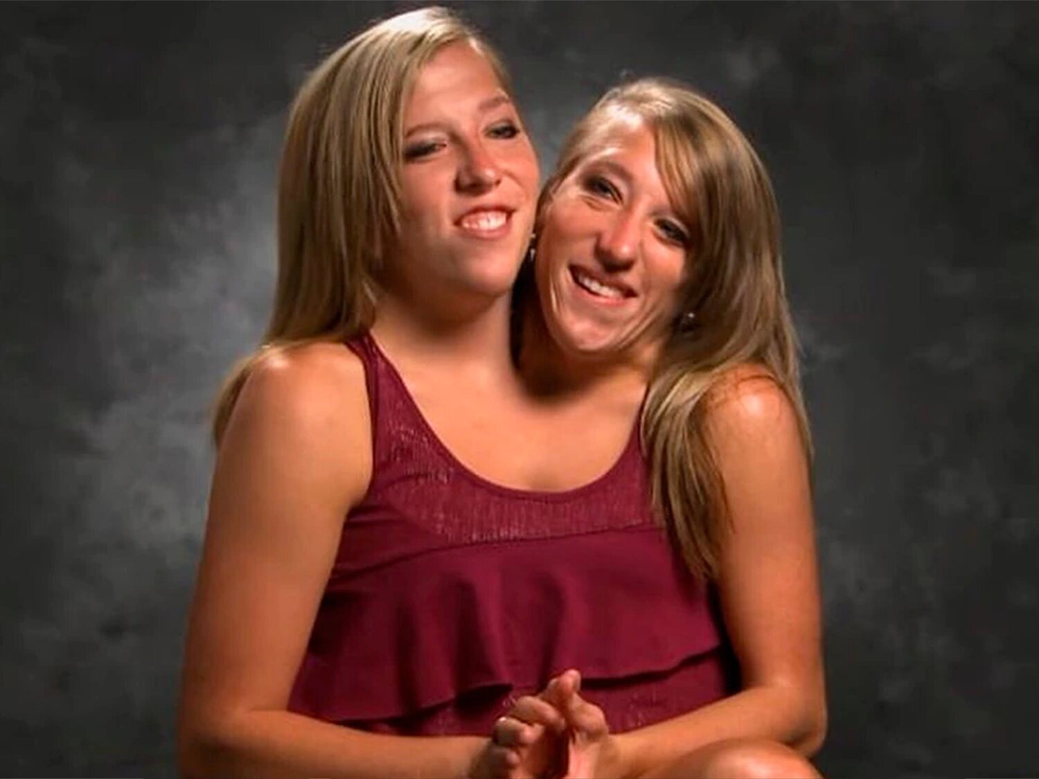 Dos vidas en una: la historia de superación de las siamesas Abby y Brittany Hensel
