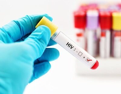 Sale al mercado la primera prueba de saliva para detectar el VIH en casa