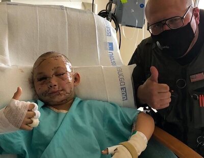 Una niña de nueve años sobrevive al ataque de un puma en Washington