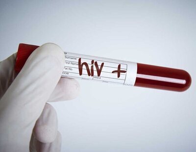 Este innovador tratamiento controla el VIH sin necesidad de antirretrovirales