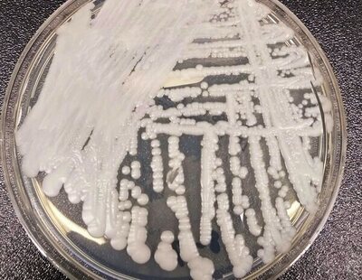 Así es Candida Auris, el 'hongo asesino' resistente a los fármacos que infecta más por el calentamiento global