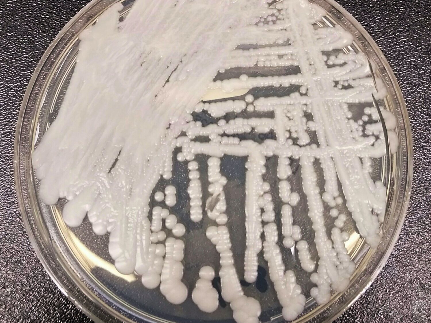 Así es Candida Auris, el 'hongo asesino' resistente a los fármacos que infecta más por el calentamiento global