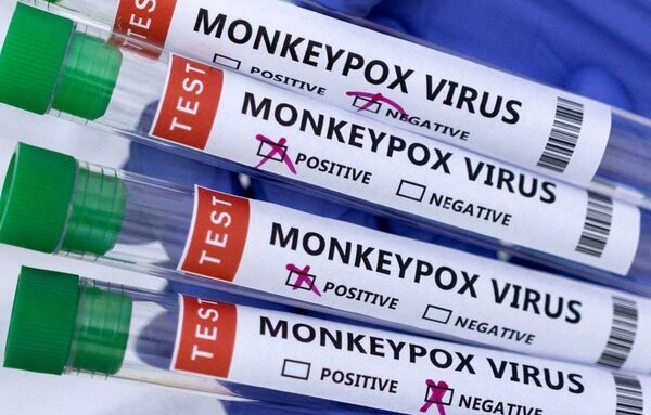 España registra la segunda muerte por viruela del mono