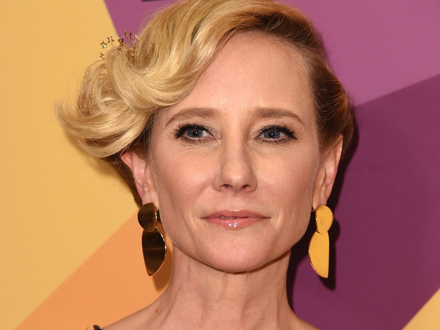 Anne Heche, en muerte cerebral: no se espera que sobreviva