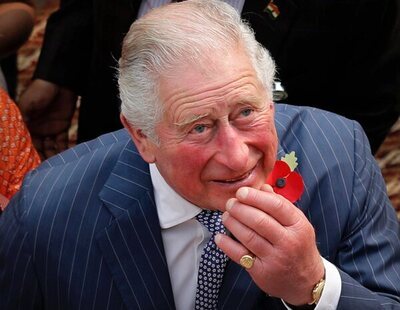 ¿Por qué el rey Carlos III tiene los dedos tan rojos e hinchados?