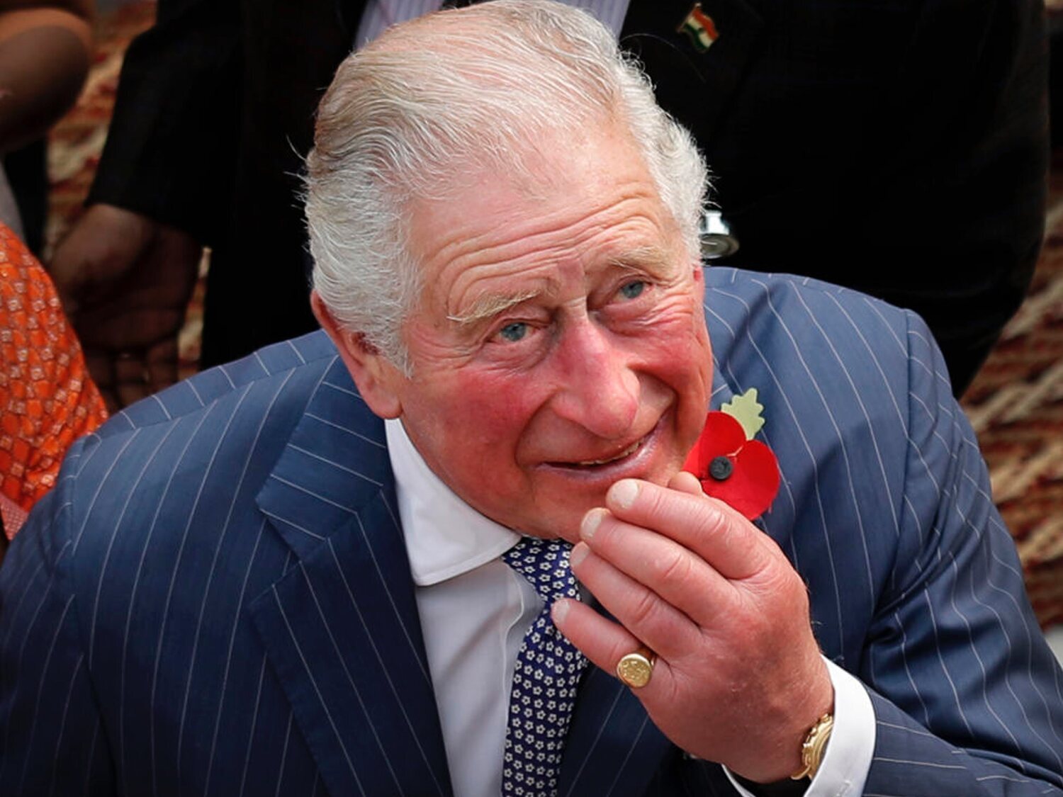 ¿Por qué el rey Carlos III tiene los dedos tan rojos e hinchados?