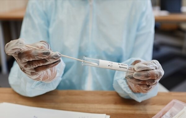 El primer test de orina que predice el riesgo de ingresar en la UCI por contagio de coronavirus
