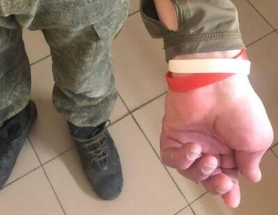 Rusia recluta a prisioneros con VIH y hepatitis para enviarlos a la guerra: los identifica con pulseras