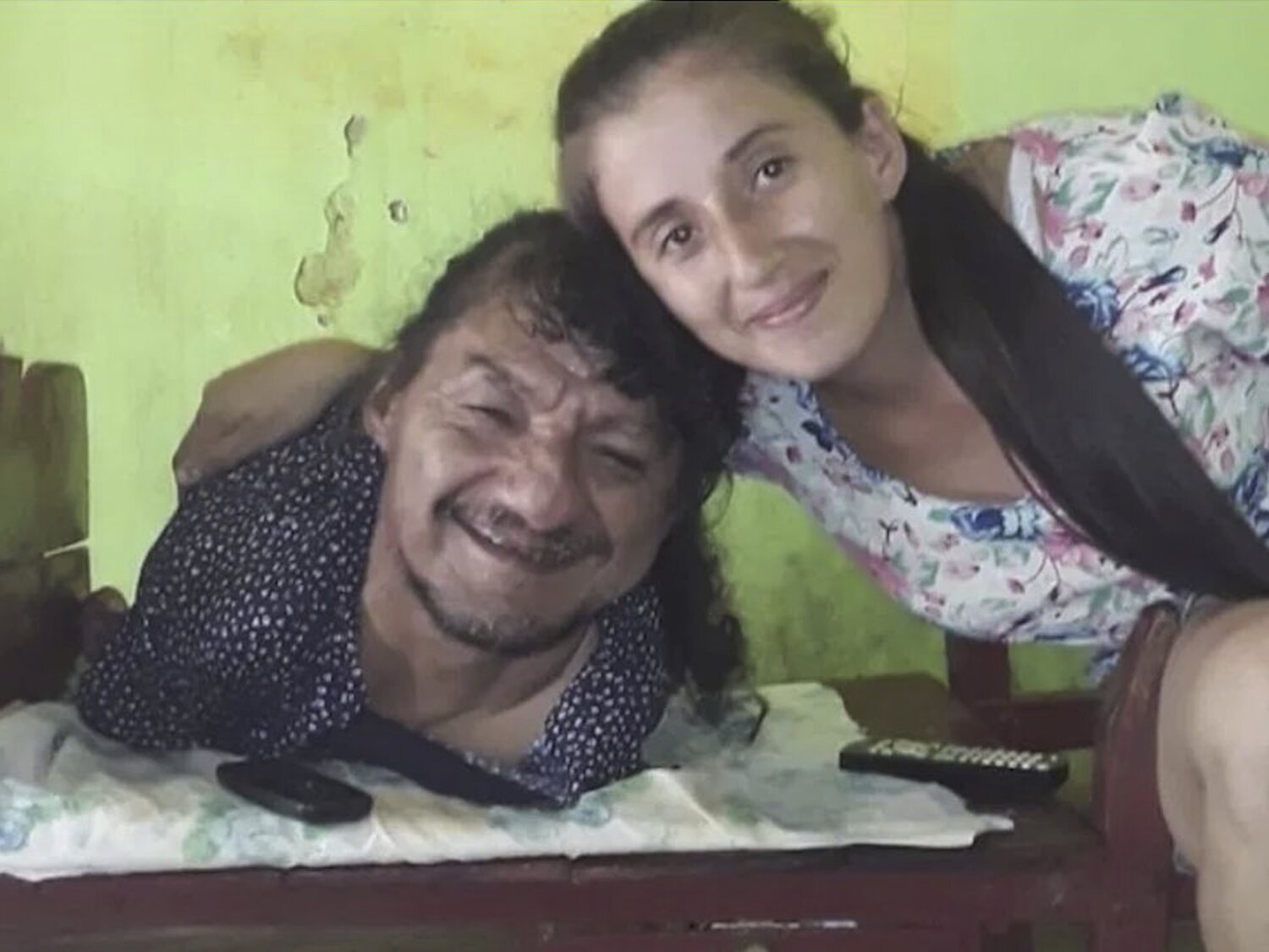 Pablo Acuña, el hombre sin piernas ni brazos que ha criado solo a sus dos hijas: "Es el mejor papá del mundo"