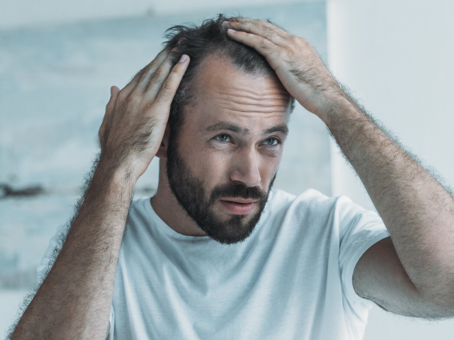 Alerta sanitaria: vinculan el consumo de estas bebidas con problemas de calvicie en hombres