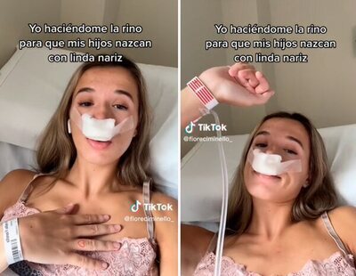 Una tiktoker recibe cientos de burlas por su vídeo sobre su rinoplastia: "Para que mis hijos nazcan con linda nariz"
