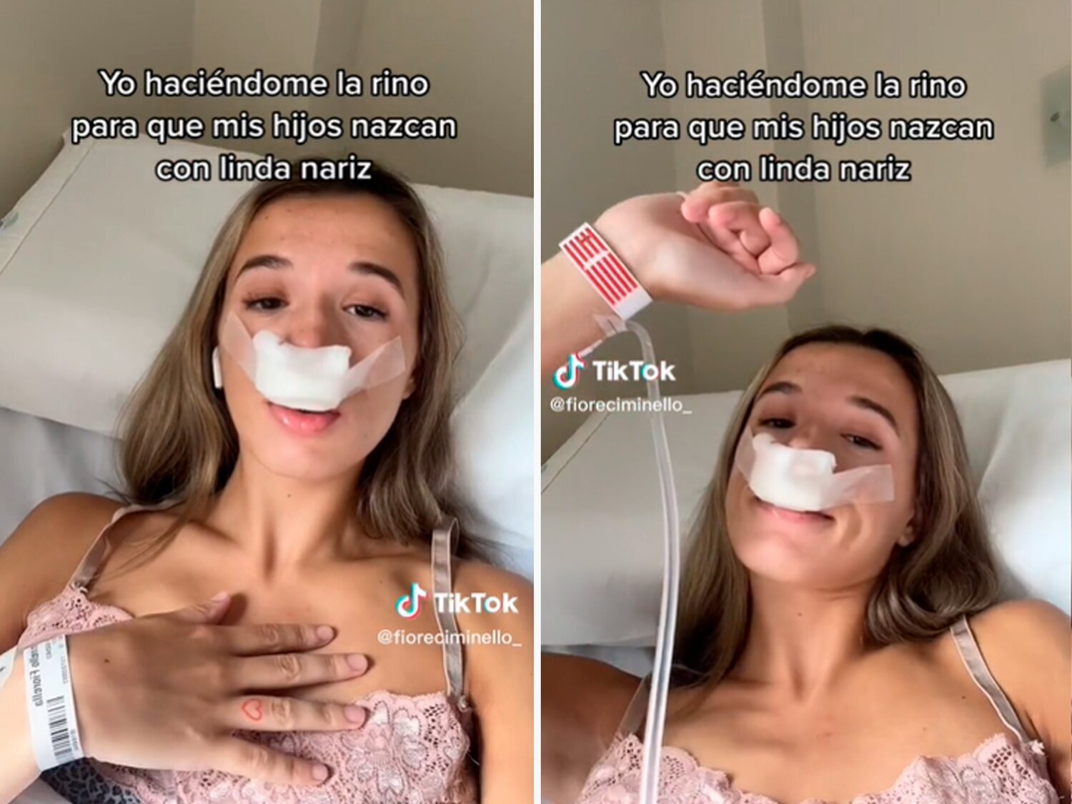 Una tiktoker recibe cientos de burlas por su vídeo sobre su rinoplastia: "Para que mis hijos nazcan con linda nariz"