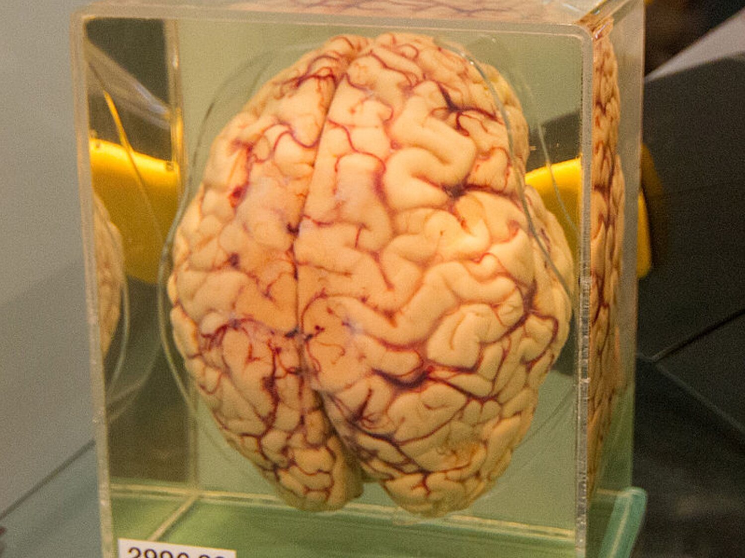 ¿Por qué Dinamarca guarda 10.000 cerebros en un sótano? Este es el polémico motivo