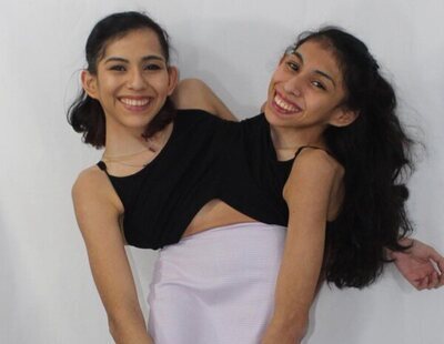 Carmen y Lupita: las hermanas siamesas explican su día a día y cómo viven el amor