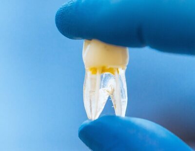 Impulsan un fármaco que regenera los dientes caídos