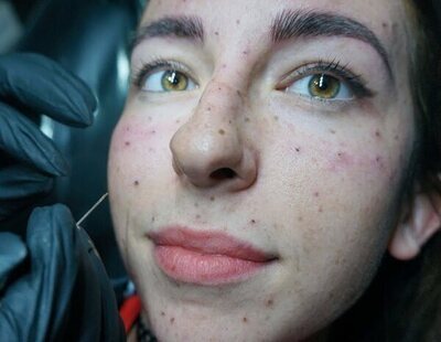 Tatuaje de pecas en la cara, la nueva tendencia en belleza: ¿es seguro?