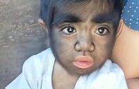El insólito caso de Jaren, el niño más peludo del mundo: su madre cree que está "maldito"